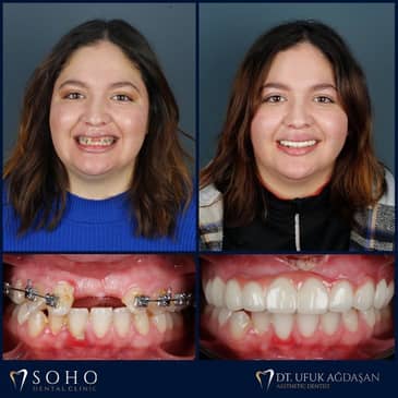 Slider image (7) Soho Dental Clinic